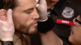 UFC 141: Lesnar vs. Overeem - PPV (2011) HDTV 720p 